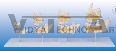 The model of teeth development (newborn, 5years, 9years and 20years)